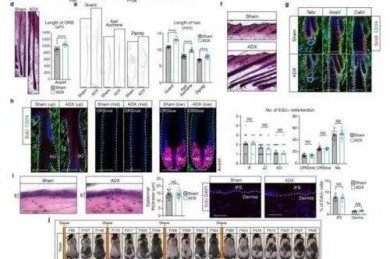 困扰90%研究者的难题：什么导致脱发 论文，到底该怎么写？