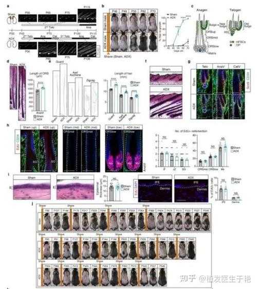 困扰90%研究者的难题:什么导致脱发 论文,到底该怎么写?