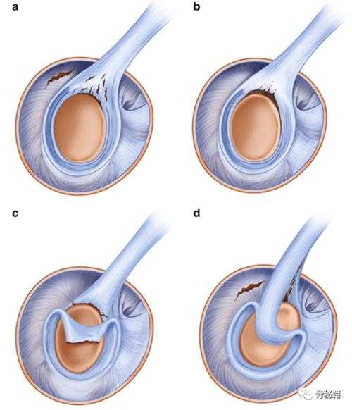 还在为缩写头疼？一文彻底讲透“论文jdpc代表什么”
