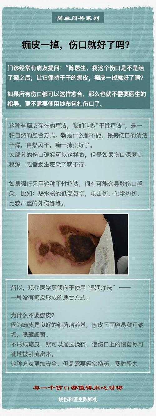 伤口为什么结痂论文